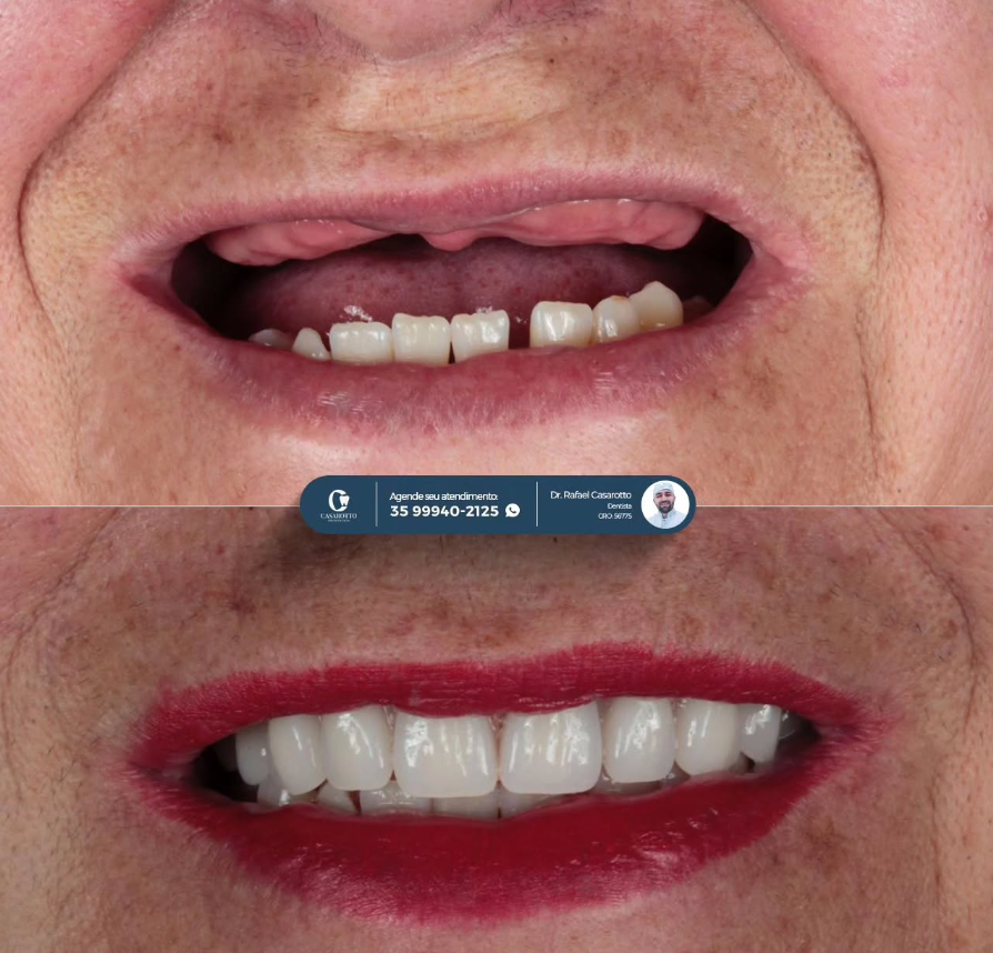Transformação completa do sorriso
