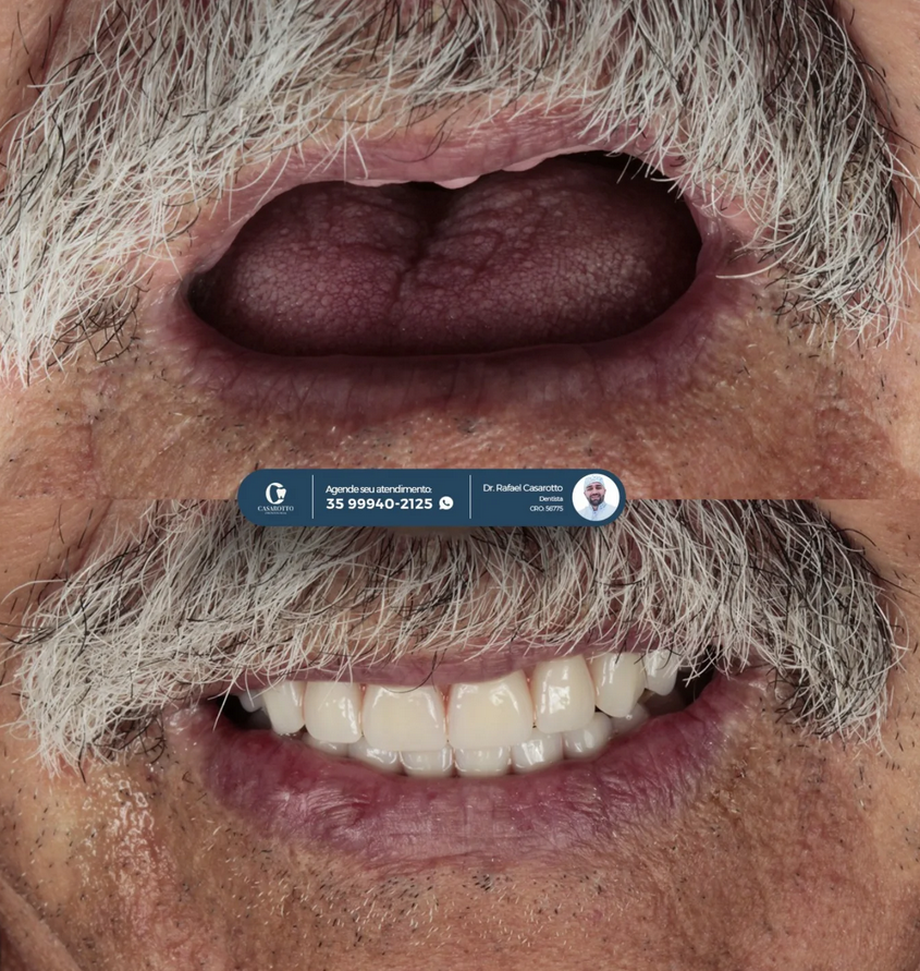 Transformação dental