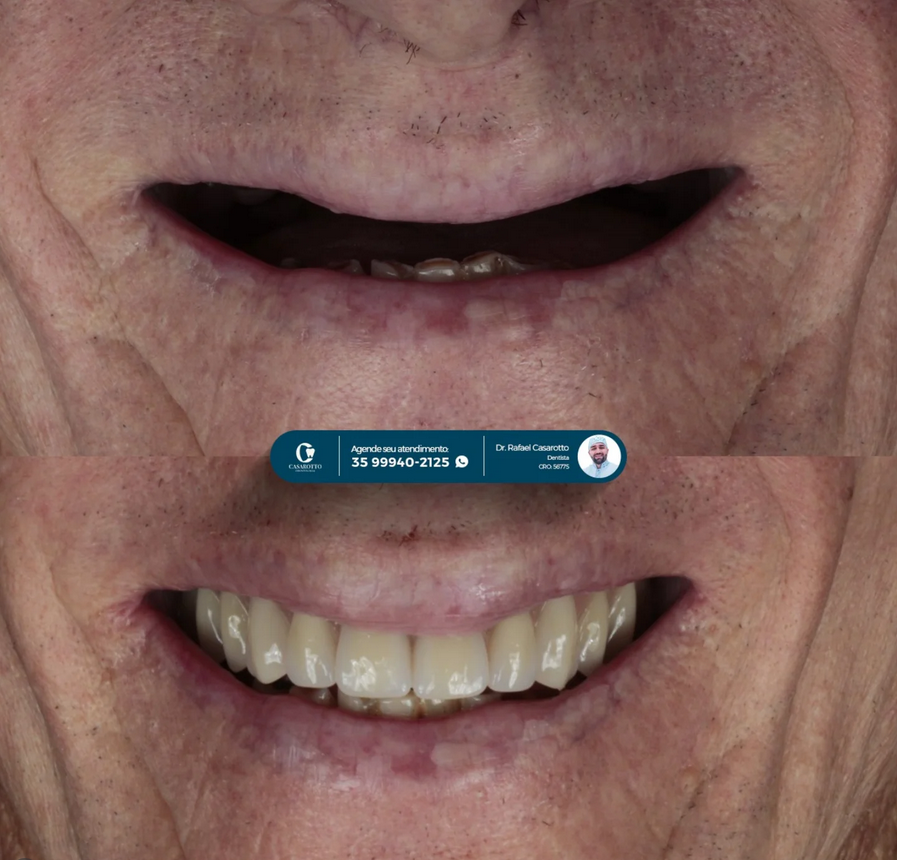 Correção estética
